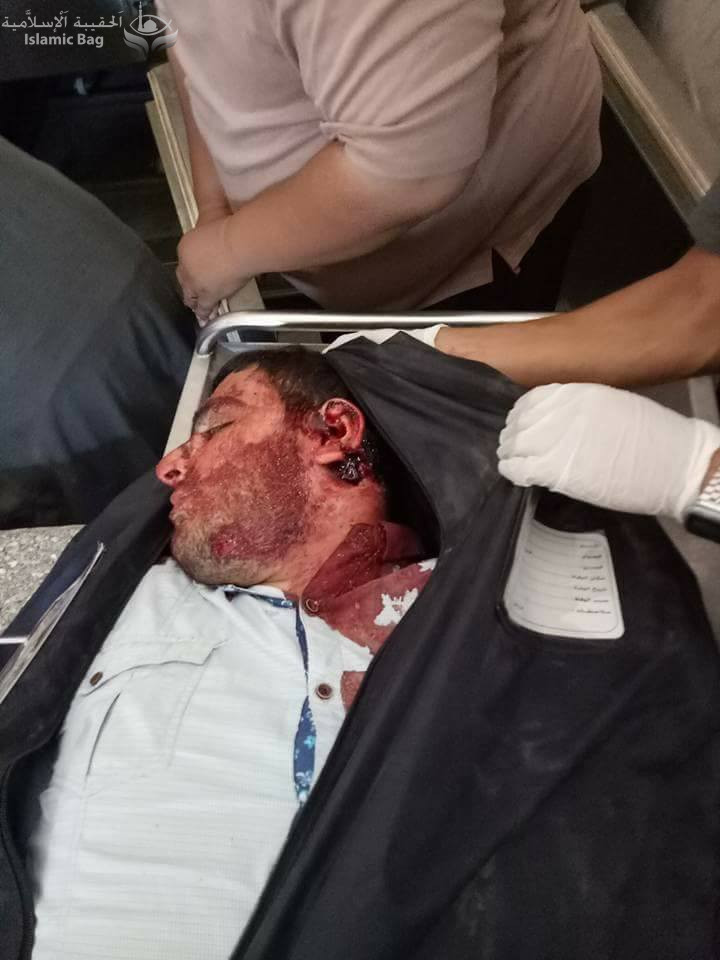 مصر .. أستشهاد 28 قبطي في هجوم بالرصاص على حافلة تقلهم