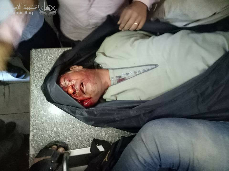 مصر .. أستشهاد 28 قبطي في هجوم بالرصاص على حافلة تقلهم